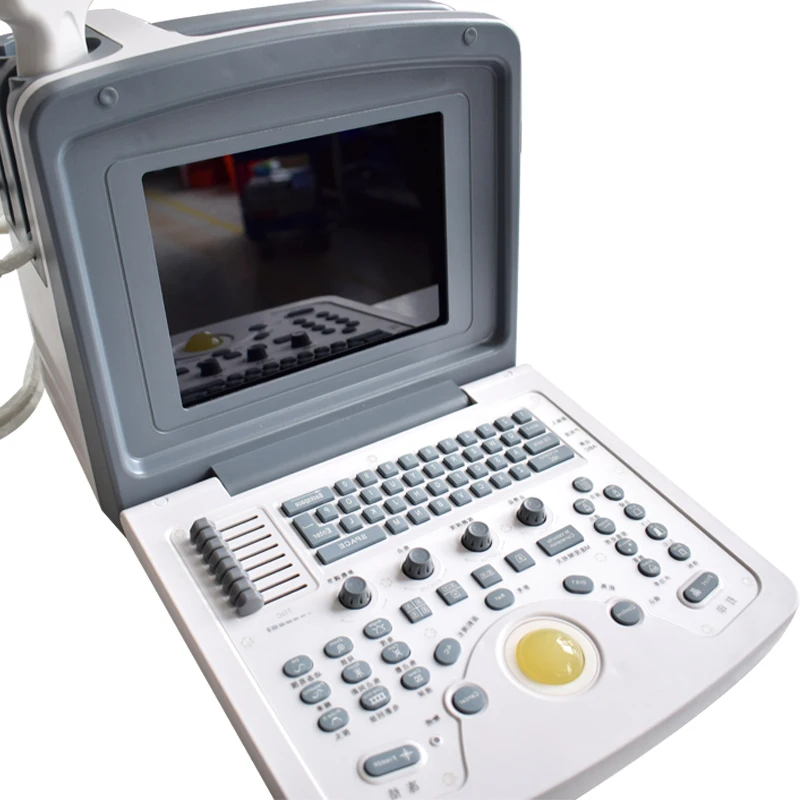 Intraoperative ultrasound machine diagnostic point of care portable machine a ultrasons