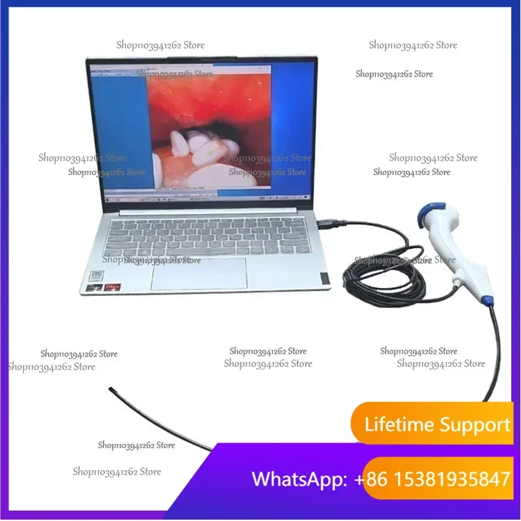 Hot Selling Veterinary Endoscope Item Excellent Quality Diagnosis Treatment Device Portable Flexible Veterinary Dog EndoscopyCE