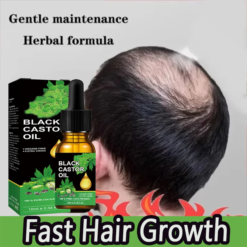 

Unisex Hair Growth Oil Anti Hair Loss Rapid Effective Baldness Repair Hereditary Postpartum Hair Loss Rosemary Essential Oils