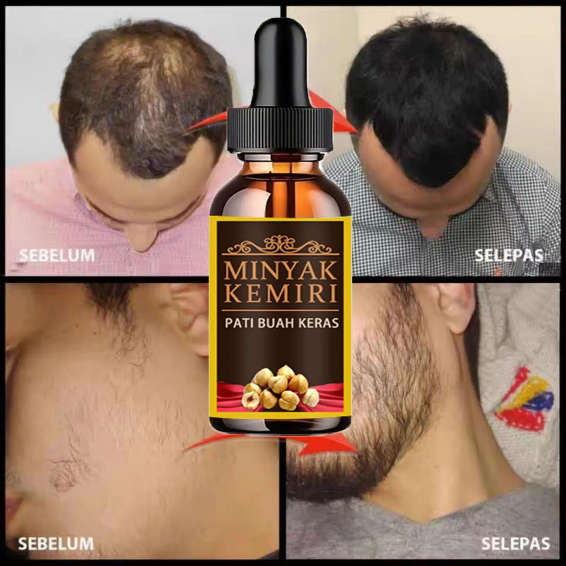Men Grouth Hair Beard Growth Oil 100% Natural Hard Nut Oil Essence for Beard and Hair Products