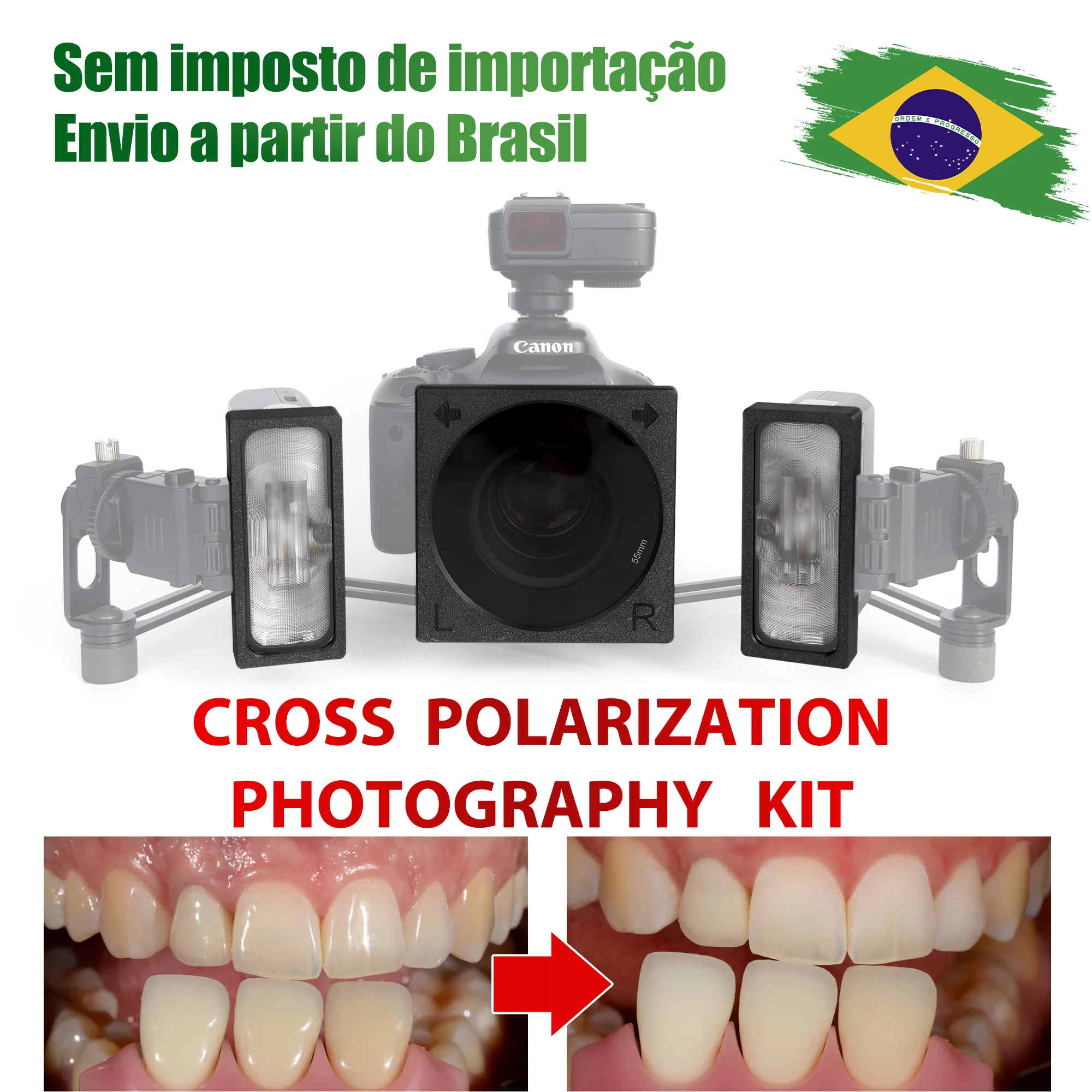godox-mf12-flash-with-cross-polarization-filter-–-removes-reflections-and-glare-macro-dental-intraoral-and-aesthetic-photogra