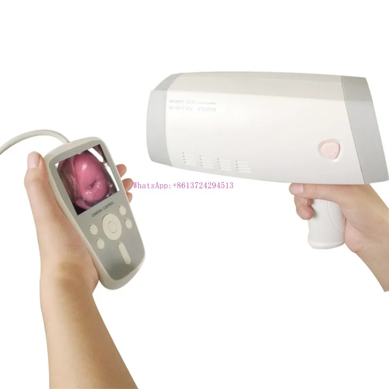 Good quality easy to operate digital colposcope with screen display