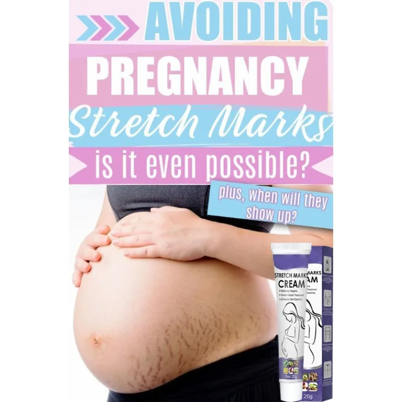 

ᴴᴼᵀ Gentle Skin Care Improves Elasticity Effective After Pregnancy Stretch Marks Removal Powerful Maternity Cream Nourishes Skin