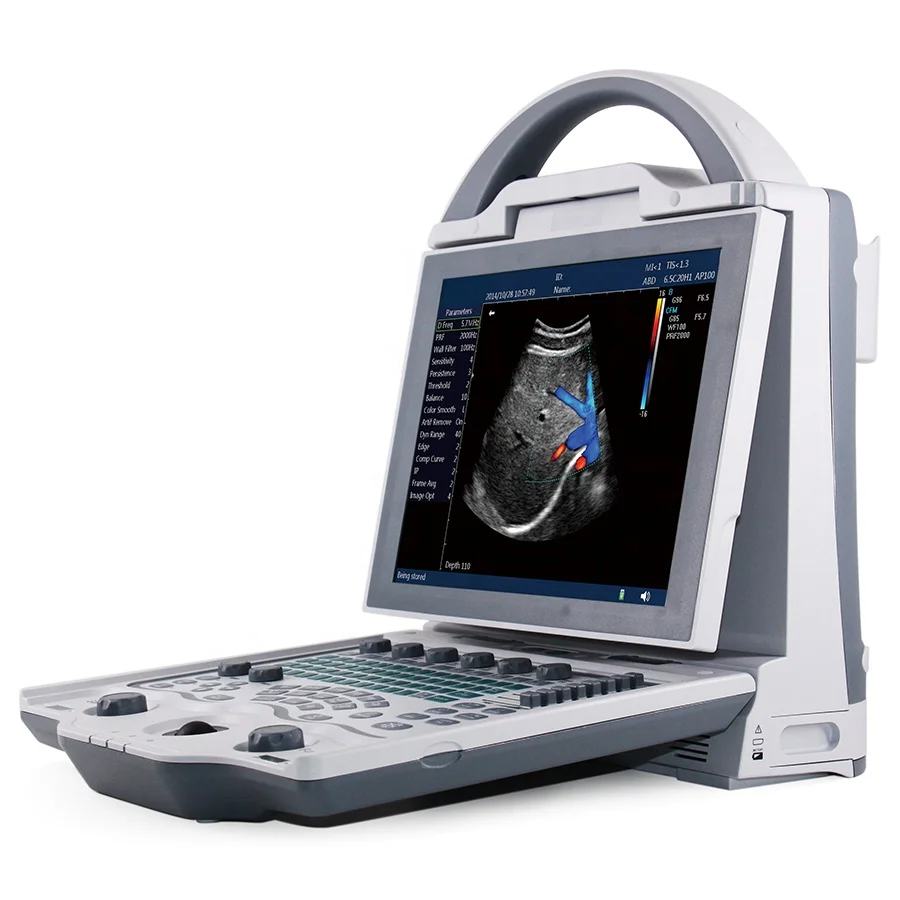 Hand Held Color Ultrasound Machine Sonoscape Small3D 4D Laptop Human Use Color Ultrasound Machine