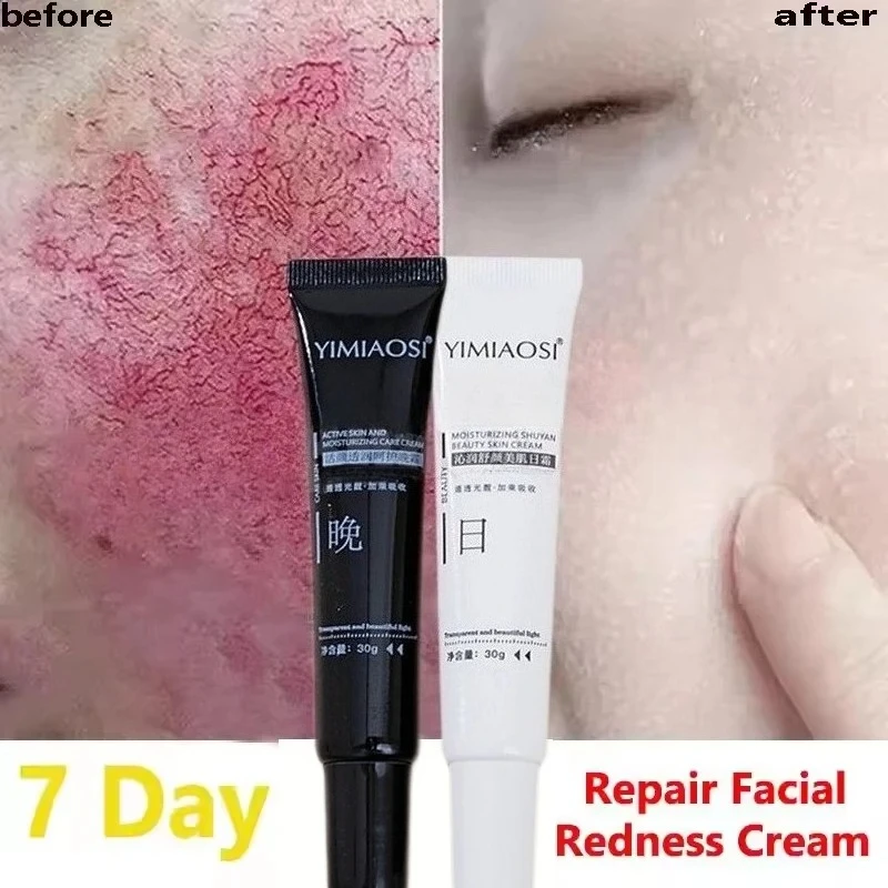 

Korean Facial Redness Repair Cream Hydrating Soothing Lotion for Sensitive Skin Rosacea Day Night Moisturizer to Improve Dryness