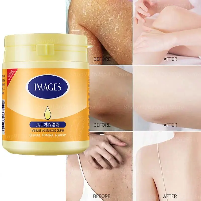 

170g Vaseline Body Lotion Moisturizing Anti-cracking Whitening Remove The Chicken Skin Body Lotion for Skin Care Autumn Winter