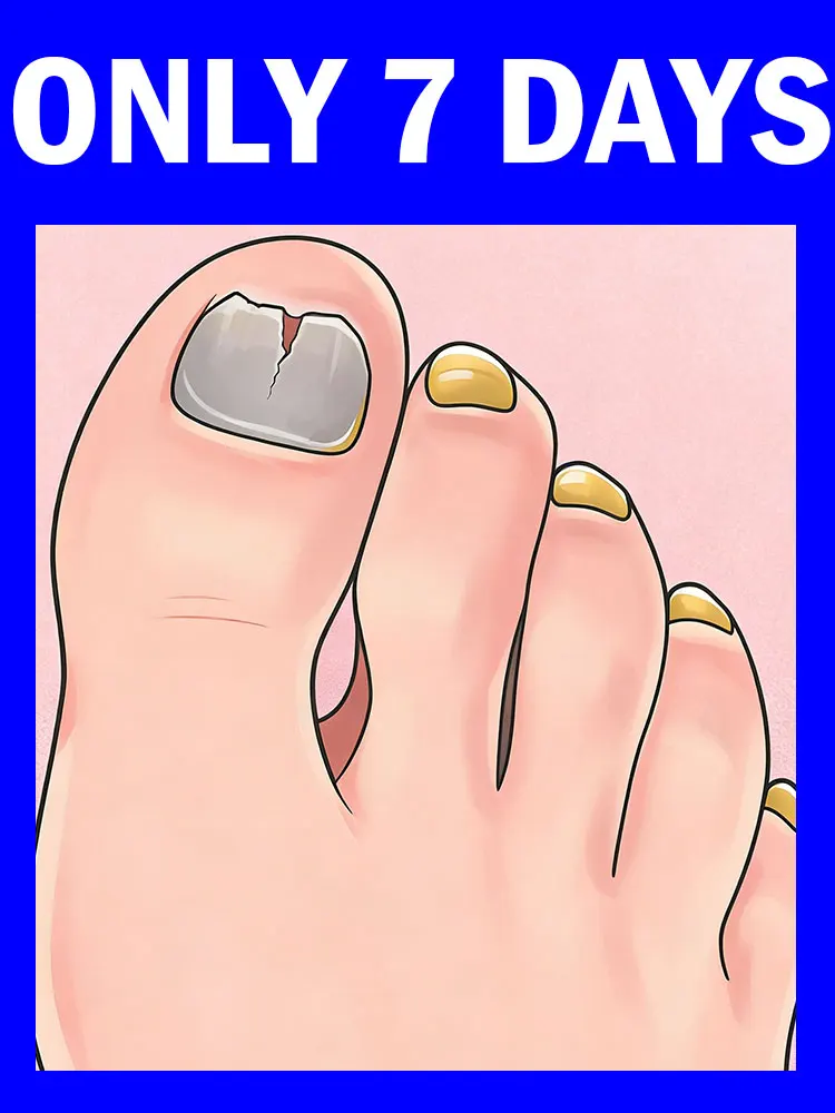 Appareil de thérapie laser à lumière bleue pour les familles, les ongles sont translucides