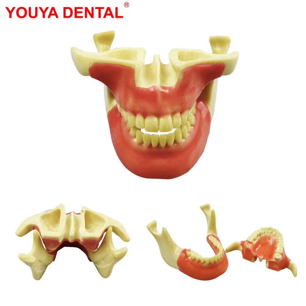 

Dental Teeth Implant Practice Model Anchorage Nail Upper Lower Implant Training Model For Teaching Studying Education Display