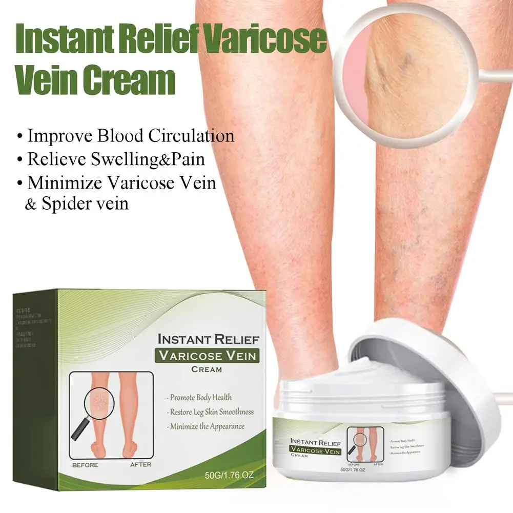 Crema reparadora de venas varicosas Tongmai, 50g, eficaz, alivia el dolor en las piernas, crema para tratamiento del dolor, vasculitis, flebitis, crema reparadora de venas