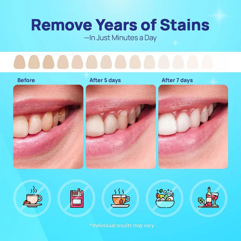 7 par/caja tiras blanqueadoras de dientes juego de blanqueamiento Dental profesional sabor a fruta de menta tiras iluminadoras de dientes 7 Kit de tratamiento