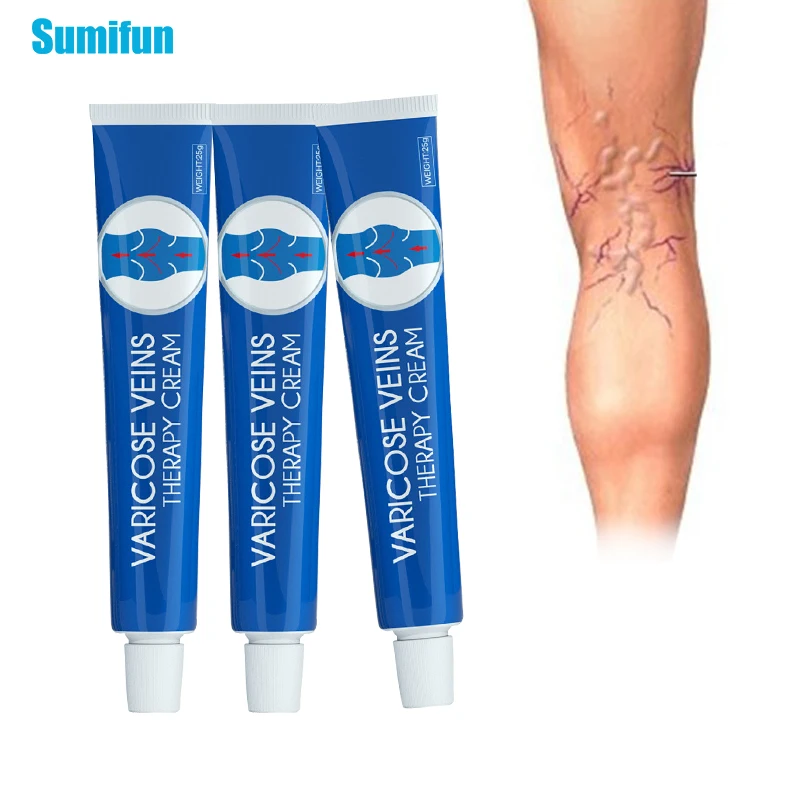 

1/2Pcs Varicose Veins Cream Calf Spider Leg Phlebitis Vasculitis Anti Swelling Blood Vessel Bulge Pain Relief Massage Ointment