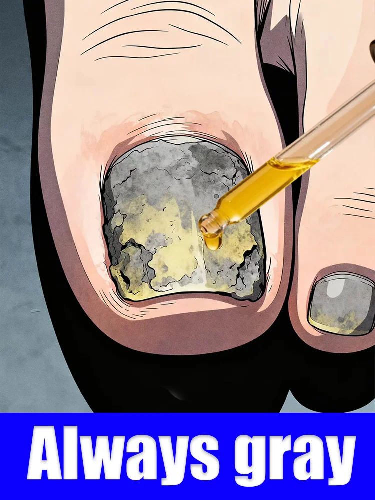 

Tools to relieve pain and discoloration at the source