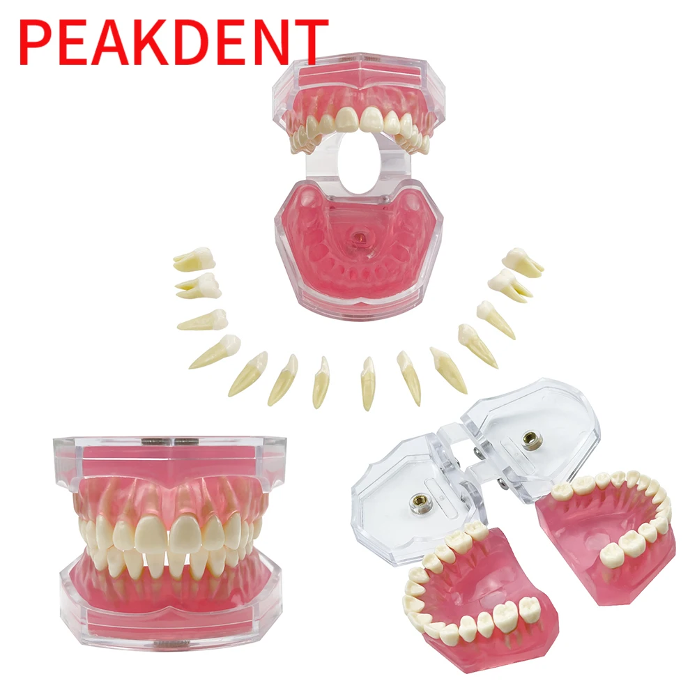 With Removable Dental Model Standard Jaw Typodont Soft Gum Dental Extraction Teaching Demonstration Transparent Model