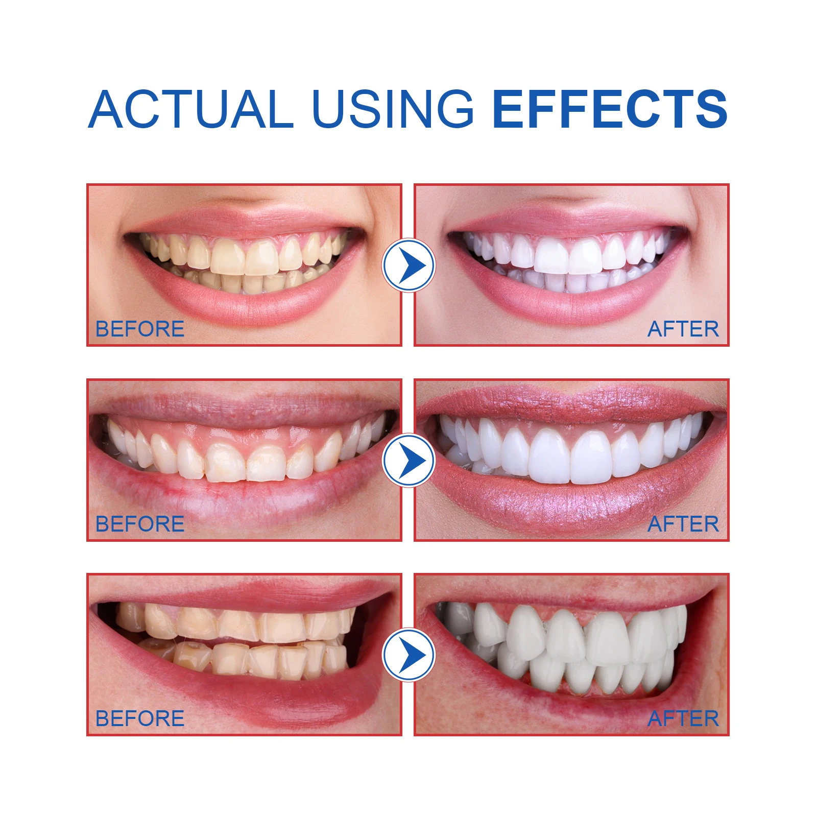 Dentifrice éclaircissant probiotique SP-6, livres d'hygiène buccale, élimination des odeurs, haleine fraîche, élimination de la coloration, blanchiment des dents, soins des dents