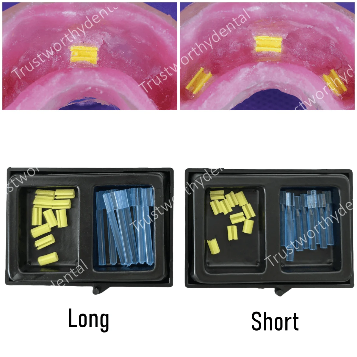 Dental Yellow Clips Overdenture Bar Attachment Retention Female Inserts Micro Hader Rider Short Long Removable