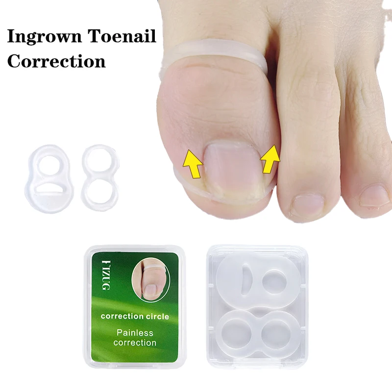 Silicone Ingrown Toenail Correction Pads Tool Invisible Ingrown Toe Nail Treatment Elastic Straightening Clip Brace