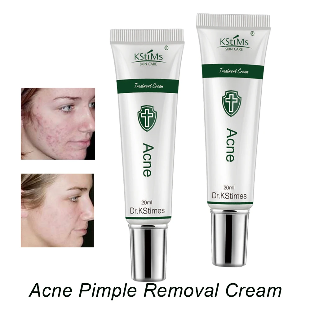 Korea Against Face Acne Oinment Pimple Remedy Anti Acne Treatment Cream for Acne Remover with Aloe Vera Tea Tree Oil in 3 Days