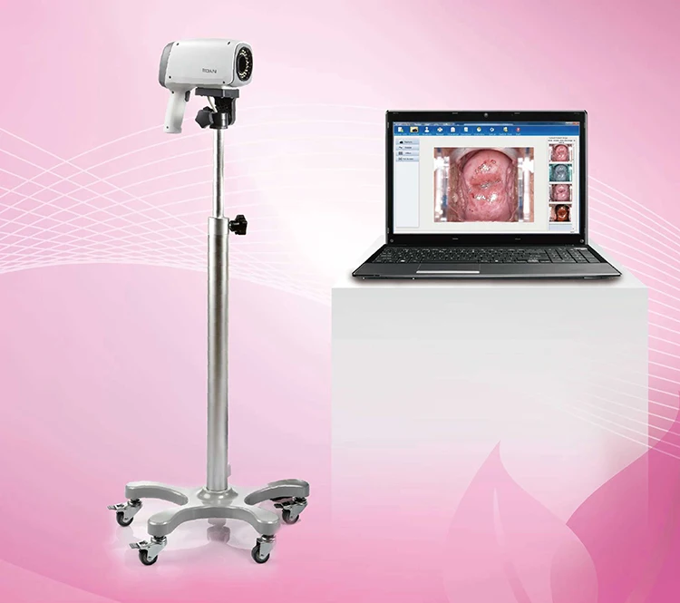 Digital Edan Video Vaginal  for Gynecology Double LED Diaphragm