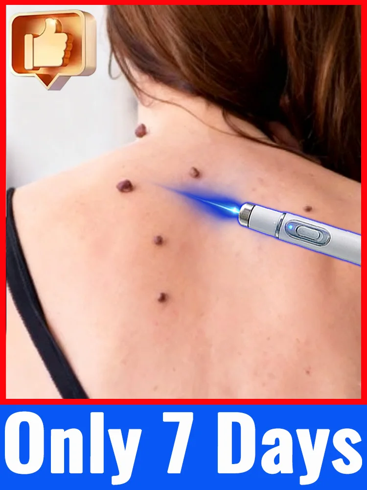 

Модернизированные бородавки 2-го поколения Безболезненный ремонт корня бородавок uickly