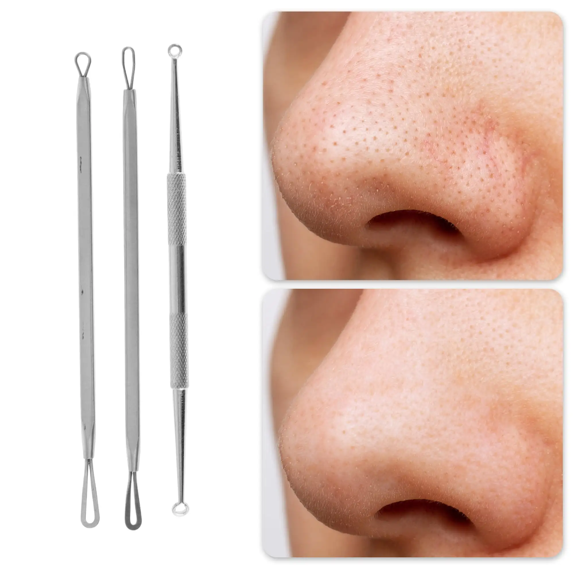 Professional Pimple Extractor Tool Kit Acne Removal Comedone Blackhead Remover Skin Care Beauty Face Tools Silver Tone view 3