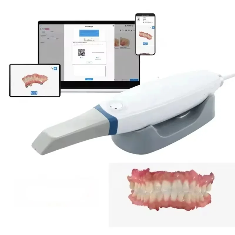 Runy 3DS V3 PRO: La Scansione Intraorale Digitale Rapida e di Alta Precisione per la Pratica Odontoiatrica Moderna