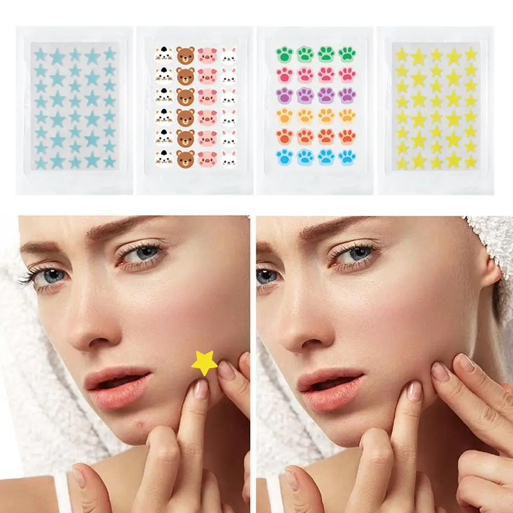 Hydrokoloidowe plastry na trądzik z motywem zwierząt z kreskówek, niewidoczne, usuwające wypryski, wodoodporne, korektor do przebarwień, naprawcze naklejki, pielęgnacja skóry.