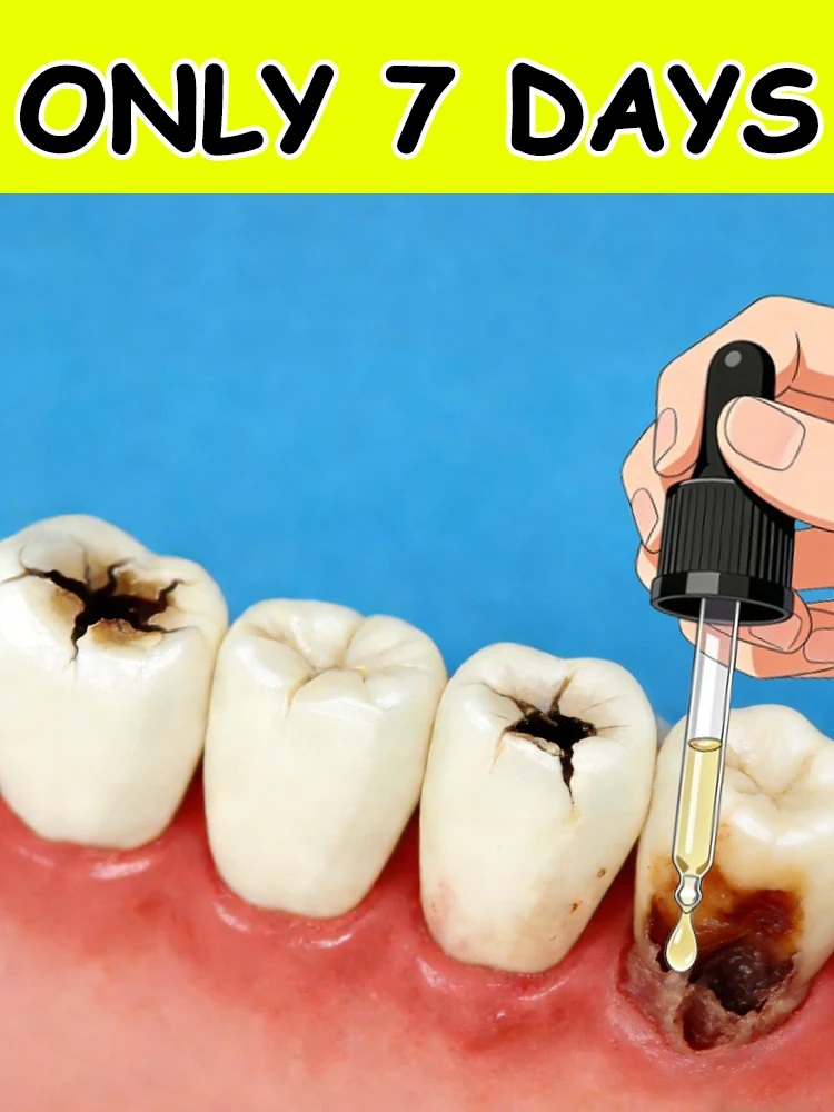 

Питает десны, ремонт десен и обхватывает зубы в течение 7 дней.