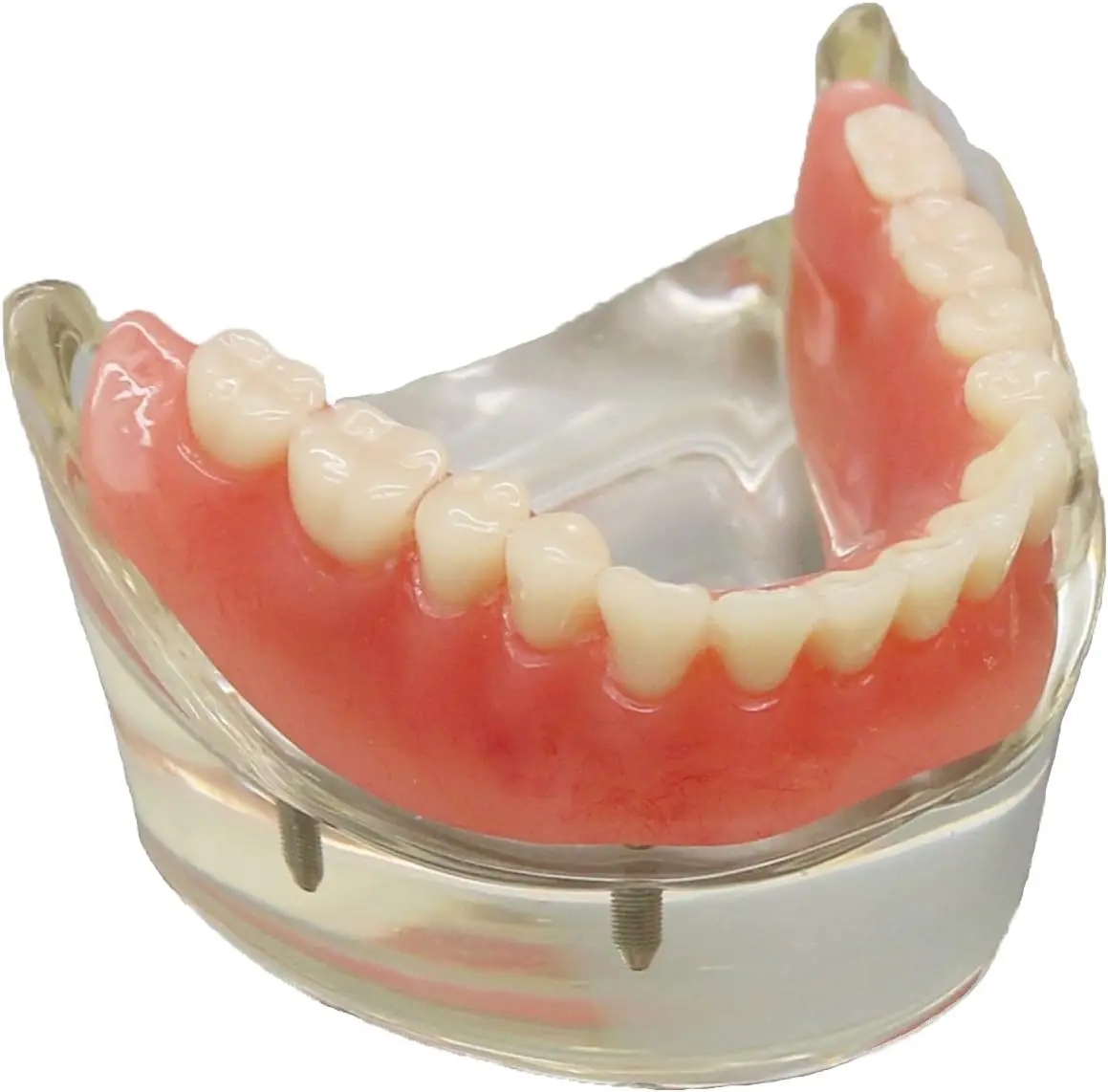 Bild 3: AG Dental-Zahnmodell für den Unterricht, Bildung, Studium, Zahnmedizin, Oberkiefer/Mandibular, Overdenture, Unterkiefer-Zahnmodell