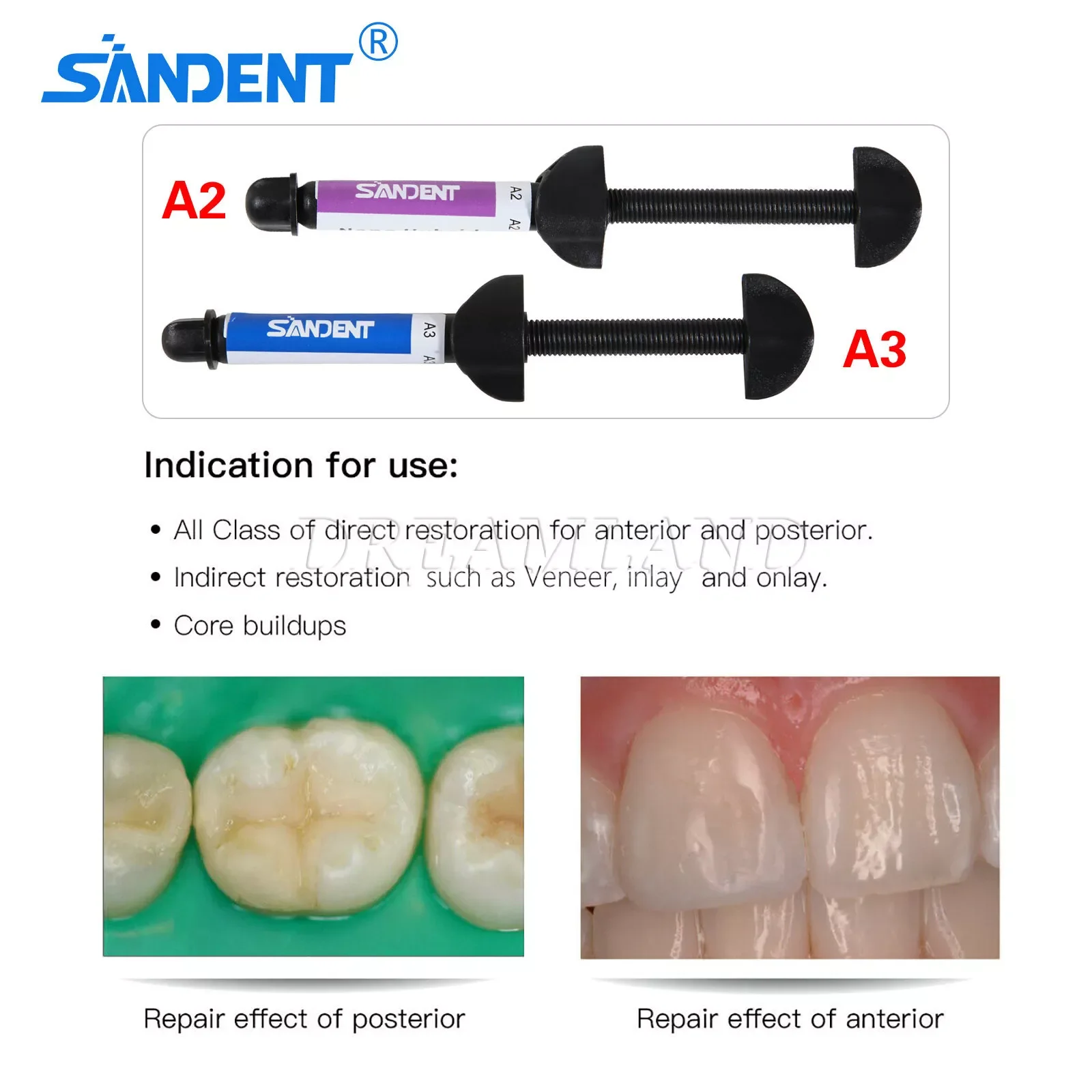 

2Types Dental Composite Universal Light Cure Resin 4g/Syringe A2/A3