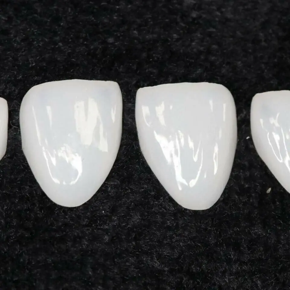 2 szt. Nr 31 # forniry dentystyczne wybielanie zębów ceramiczna jasna biała profesjonalna okleina zębów