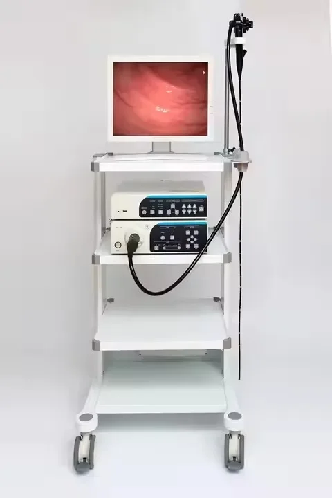 Medical Gastroscope and Colonoscope Video Gastroscope Endoscope  Endoscope System Gastrointestinal Endoscopy