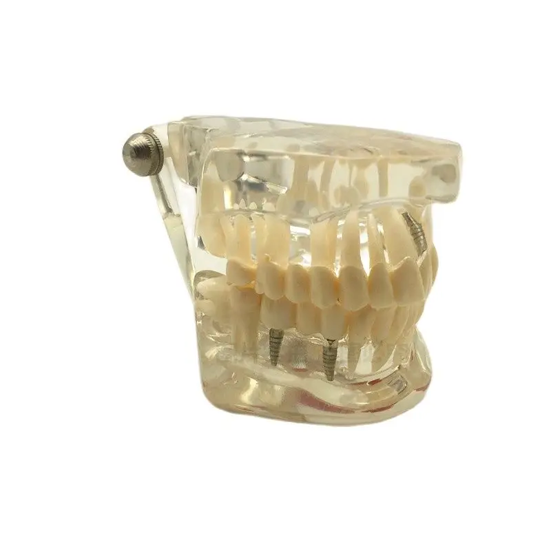 Dental Model Transparent Simulation Teeth Training