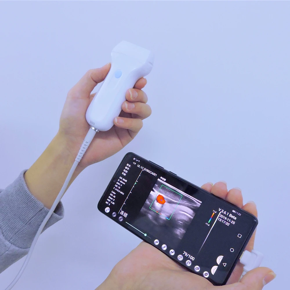 Ultrassom portátil sem fio da ponta de prova de ultrassom USB Ecografos MDR para smartphone