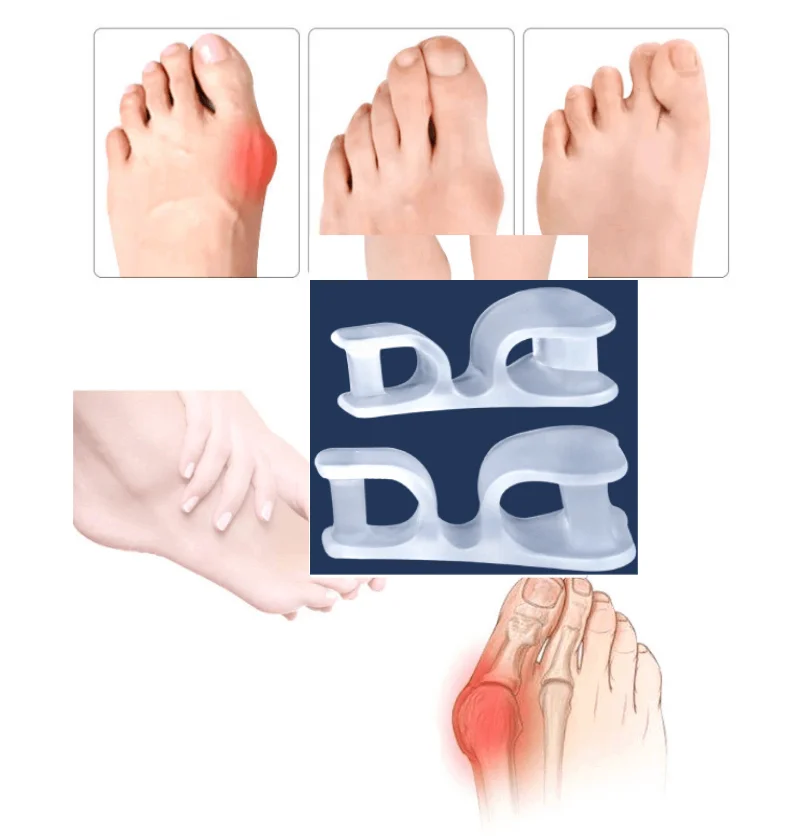 

1/2/3/4Pairs Hallux Valgus Appliance Daily Wear Silicone Foot Hallux Valgus Braces Elastic Toe Straightener Corrector for Foot
