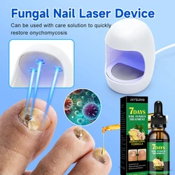 Fungal Nail Treatment Essence Oil Nail Fungus Laser Device Repair Toenail Fingernail Ginger Treatment Hand Foot Essence Liquid