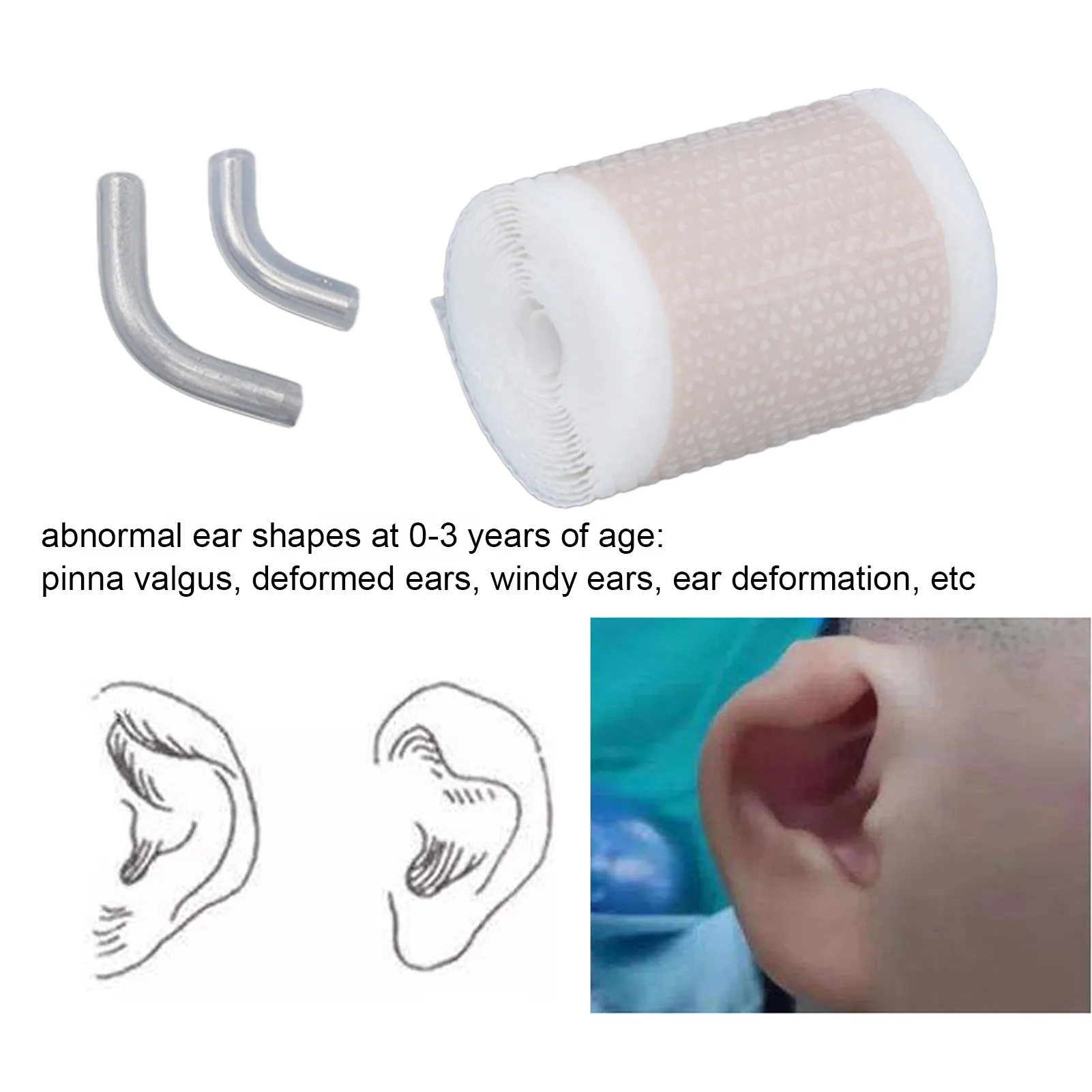 Baby Ear Corrector Auricle Silicone Correction Patch Skin Friendly Comfortable Baby Gel Ear Tape Infant Ear Patch Sticker I