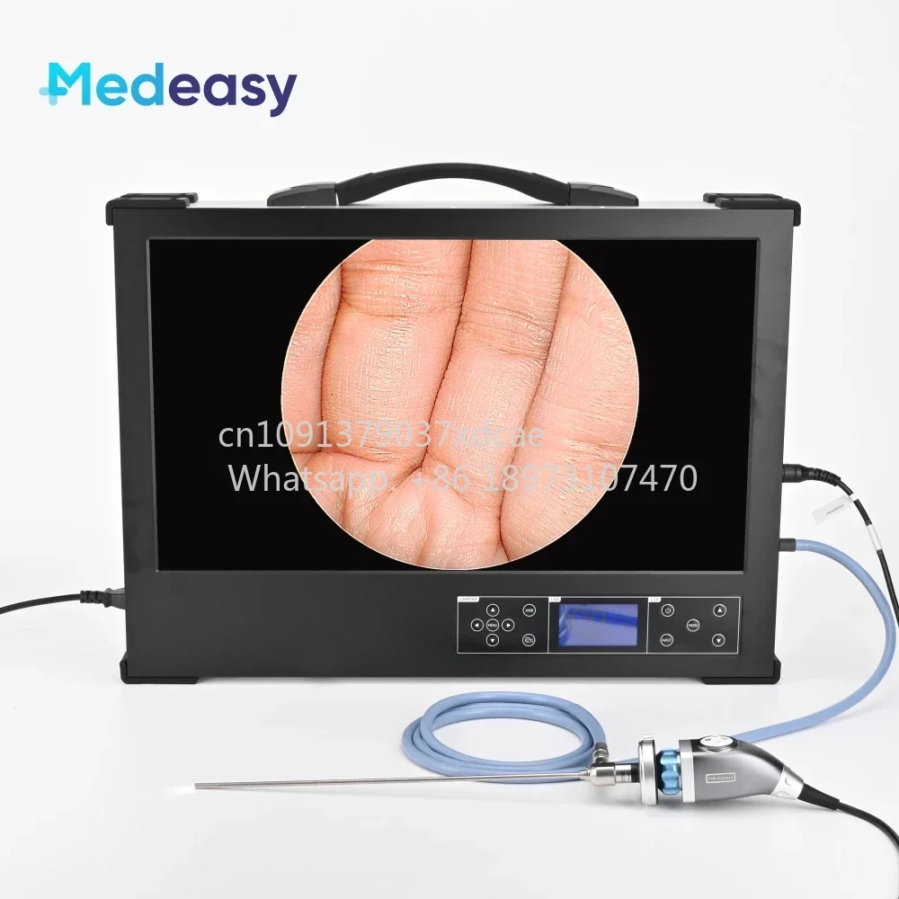 2026 NEW 24 Inch 1080P Full HD Endoscopic Camera System With . Monitor, 100W LED Cold Light Source And Record Function