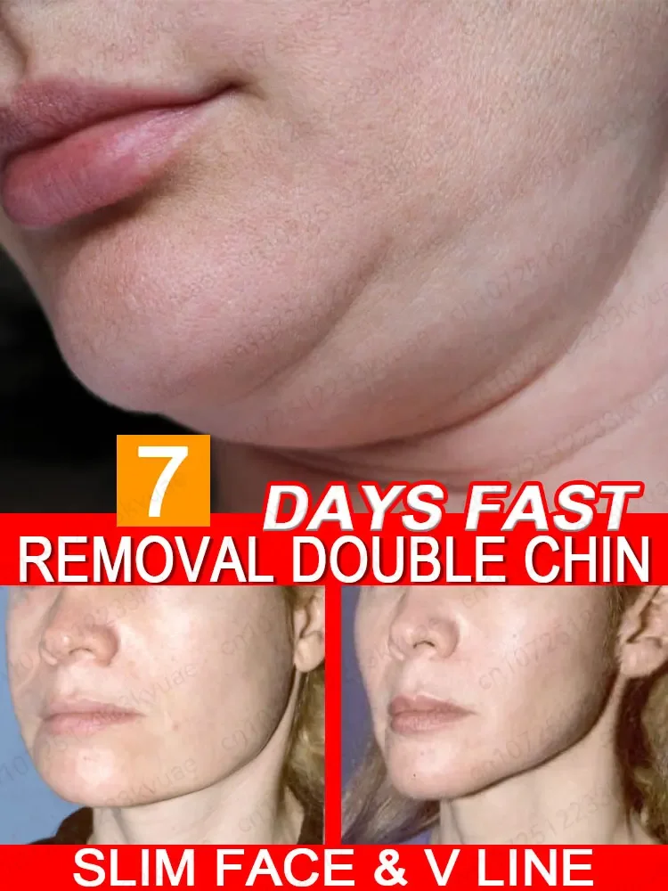 Face Slimming Cream Artifact Products V Line Face Slimming Double Chin Eliminate Slimming the Face