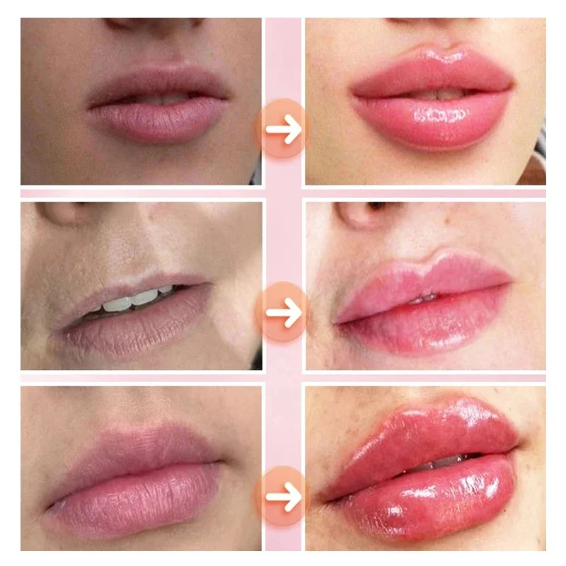 Instantâneo Volumising Óleo Essencial, Lip Plump, Elasticidade Aumentar, Reduzir Linhas Finas, Reparar Nourish, Beleza Sexy, Lip Care