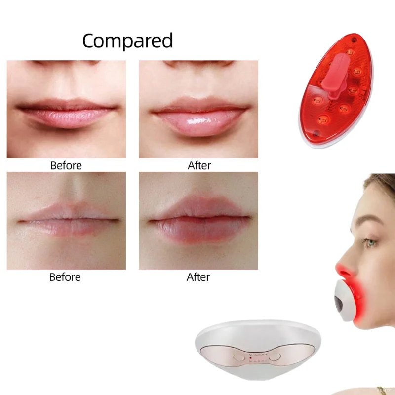 

Advanced Red LED Phototherapy Device for Lip Enhancement and Eye Wrinkle Reduction, with 4 Heat Settings, Anti Aging Care