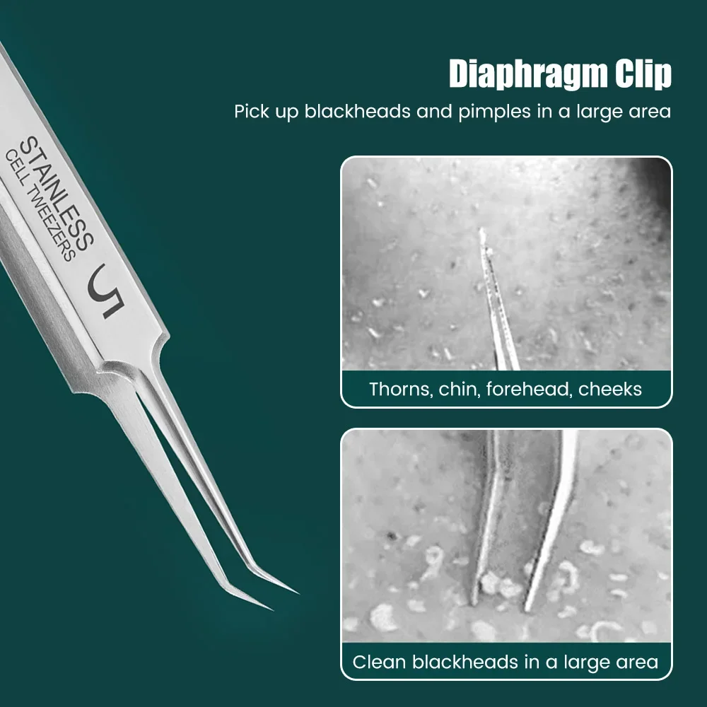 독일 초미세 셀 여드름 블랙헤드 클립 트위저, 미용실 특수 페이셜 모공 청소, 여드름 사마귀 스킨 케어 도구, No. 5