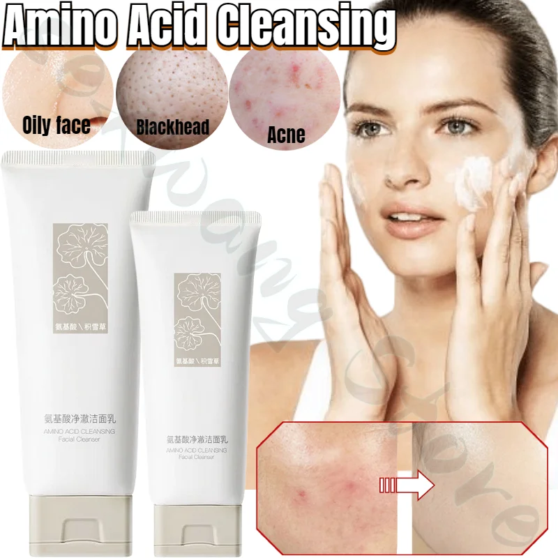 Amino Acid Purifying Cleanser Deep Cleans Pores and Blackheads Mild Foaming Fine Oil Control Facial Cleanser 100ml