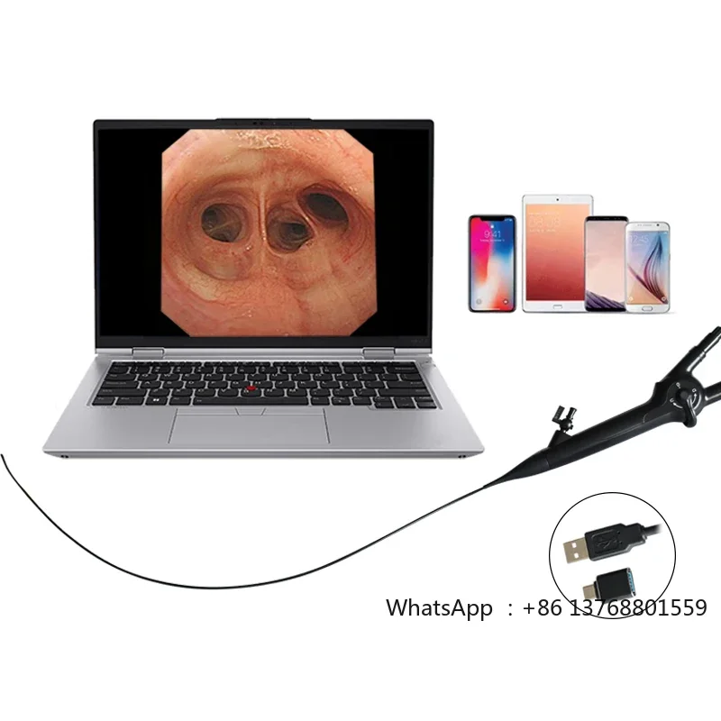 Factory Priced Integrated Endoscope System 9.0 Fr Flexible Digital Ureteroscope