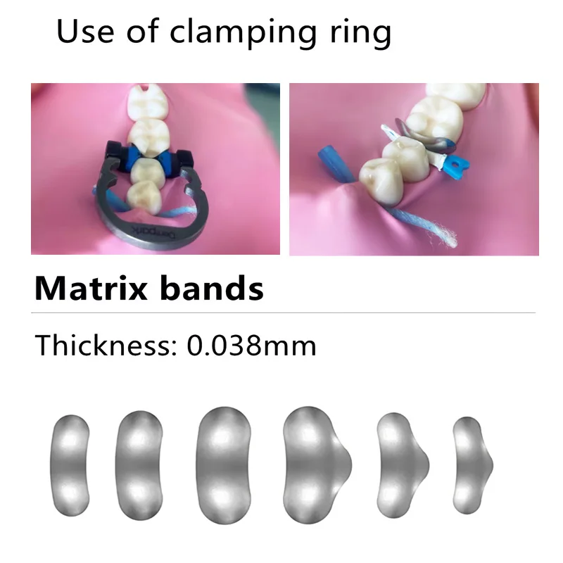 Bandes de matrice de contour sectionnel dentaire, matrices en métal dur, feuille formée, matériaux de dentiste, M10, nouveau, boîte de 50 pièces