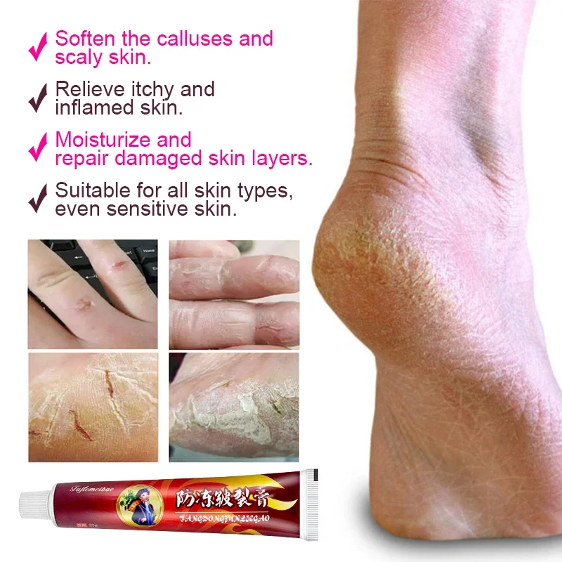 1Pcs Anti-Drying Crack Ointment Hand Foot Heel Cracked Repair Plaster Removal Dead Skin Care Chinese Herbal Medicine Cream S101