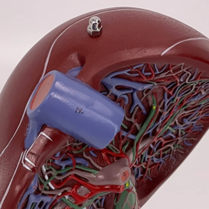

High-quality liver, pancreas, duodenum model, pancreatic structure model