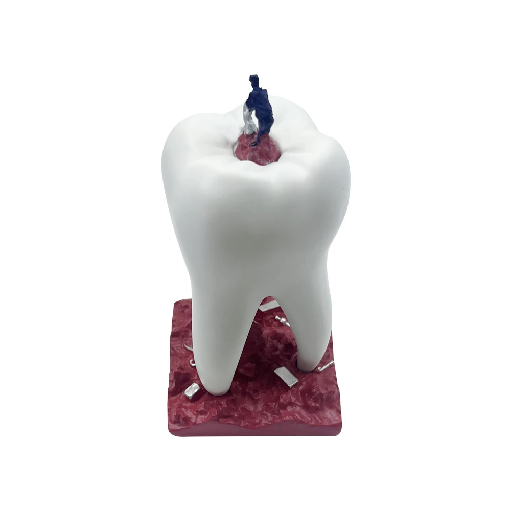 Stomatologia dekoracja Dental molowe figurki Ornament dentysta prezent klinika kreatywny pulpit rzeźba Ornament Artcraft