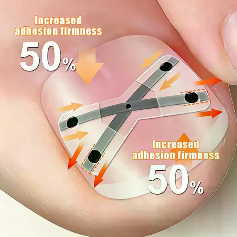 X-shaped Ingrown Toenail Correction Tool Ingrown Toenail Treatments Elastic Patch Sticker Toenail Straightening Pedicure Tool
