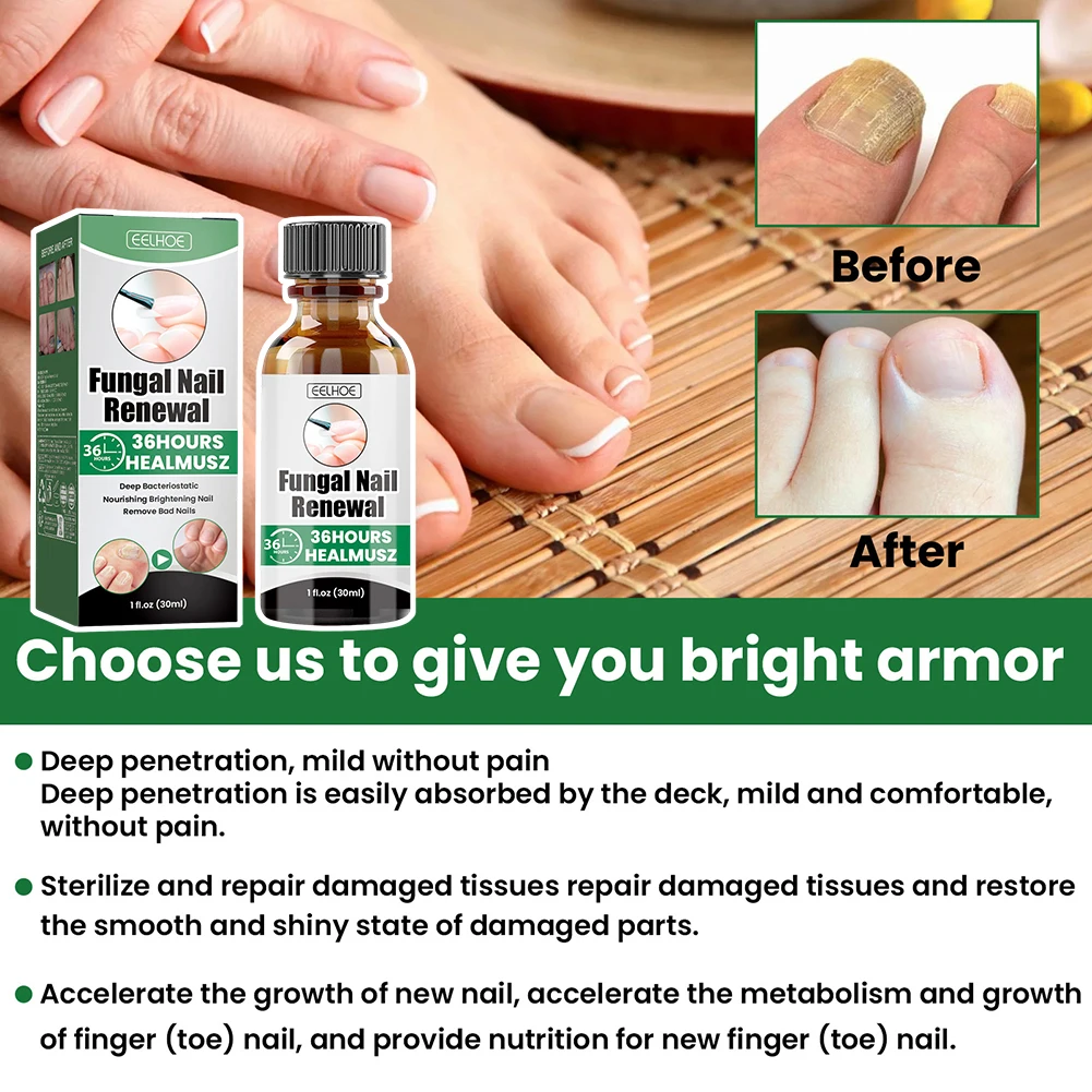 30 مللي علاجات أظافر قوة إضافية تو فطريات الأظافر تجديد القلم سريع المفعول قلم إصلاح الأظافر لتلف الأظافر المتغيرة اللون