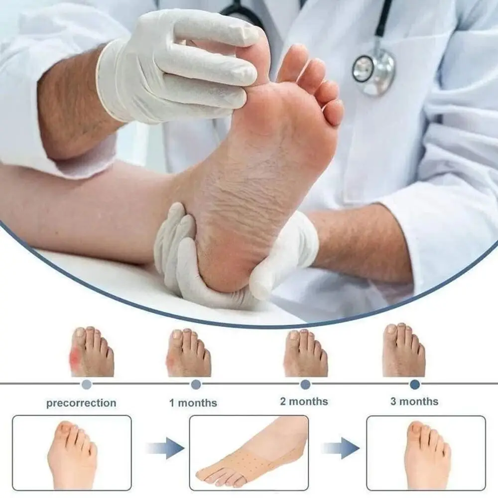 Strumenti per la cura Bunion Protector Toe plantari Brace Foot valgo Corrector Toe separatori Thumb valgo Adjuster Toe raddrizzatore